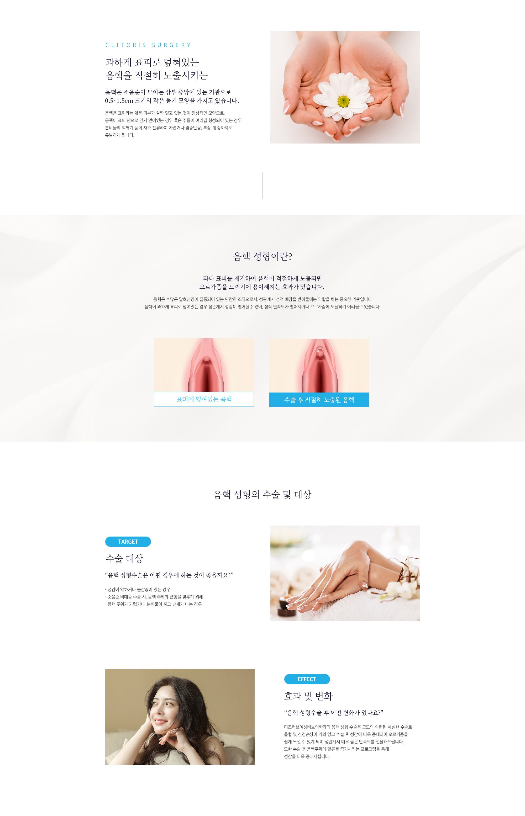 음핵 성형