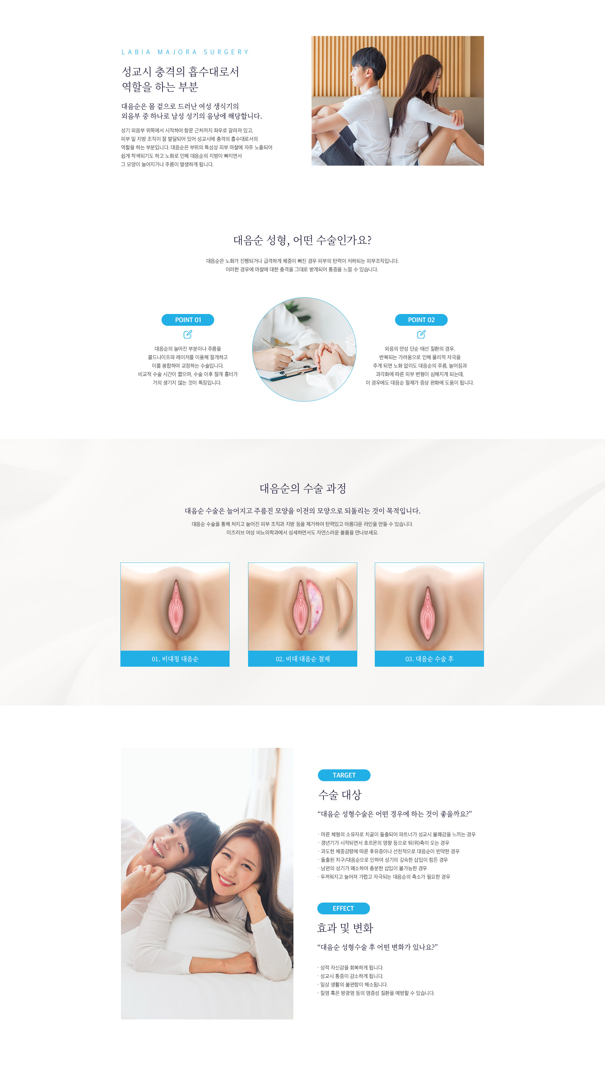 대음순 성형